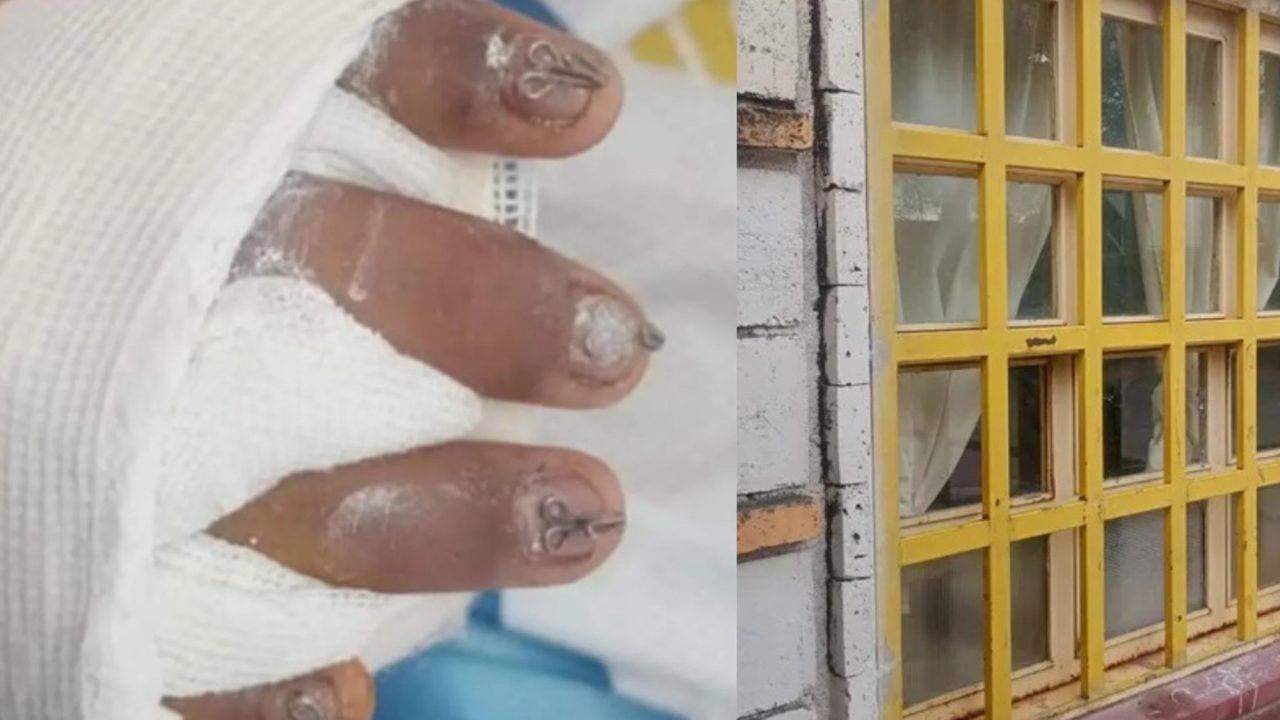 Ventana cae sobre un niño en Jujuy: Denuncian estado de abandono en la escuela