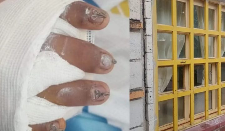 Ventana cae sobre un niño en Jujuy: Denuncian estado de abandono en la escuela