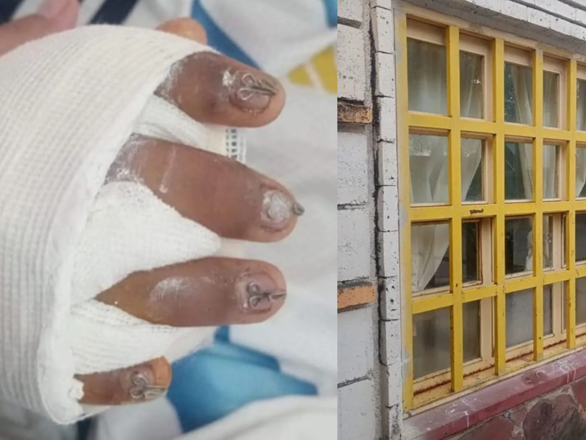 Niño recibiendo atención médica en un hospital.