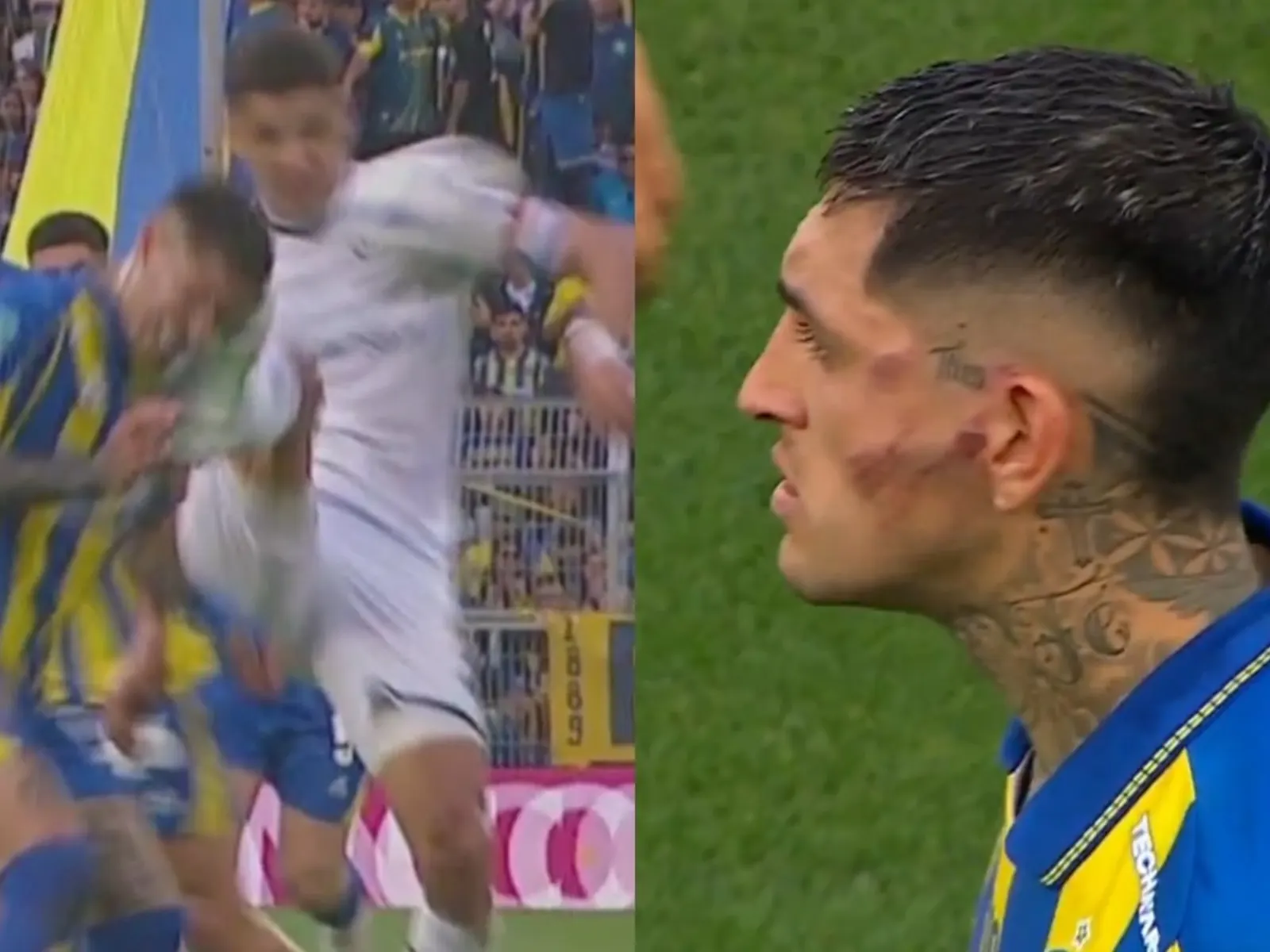 Gastón Ávila, defensor de Rosario Central, con una lesión visible en el rostro tras la patada de Álex Arce en el partido de la Liga Profesional